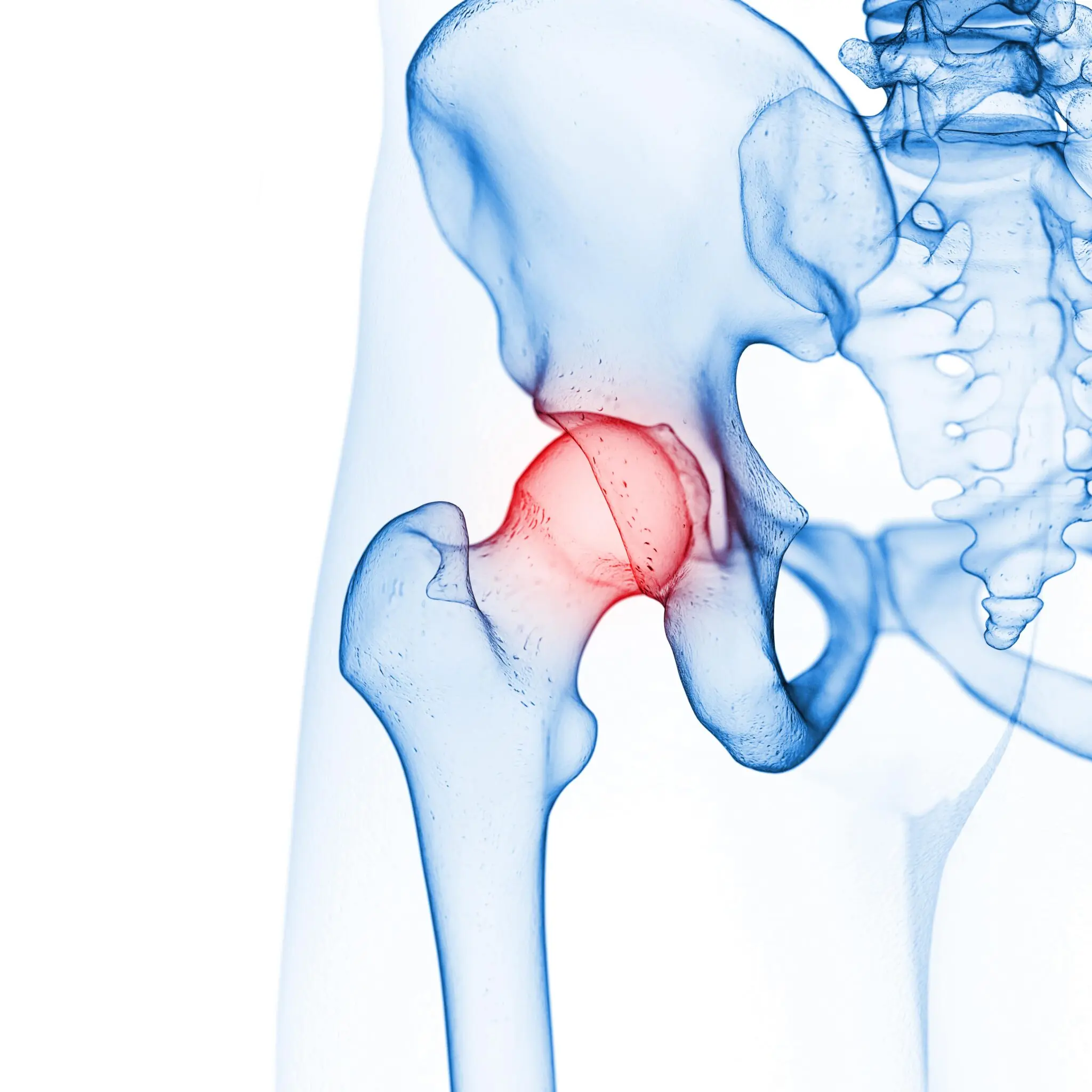 When the knee and hip hurt