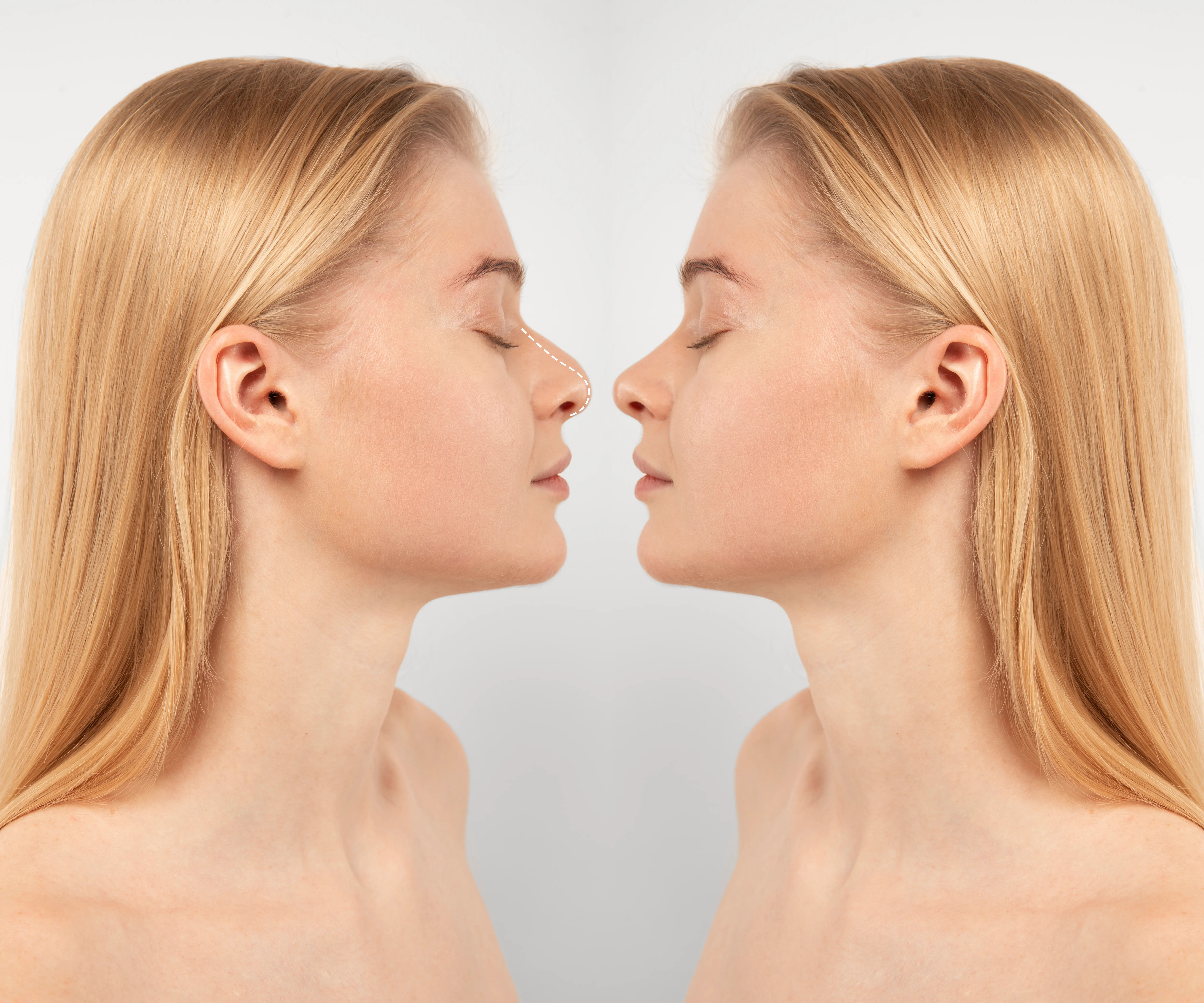 So sieht die perfekte Nase aus